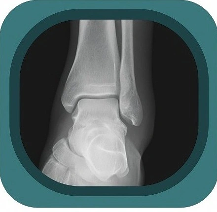 X ray ankle  anatomy icon